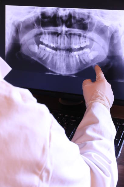 Best Emergency Dental Care for Broken or Chipped Teeth in Elkhart Lake, WI