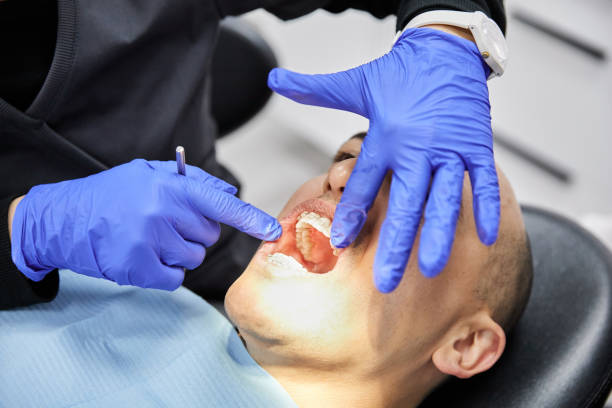 Best Emergency Dental Care for Broken or Chipped Teeth in Elkhart Lake, WI